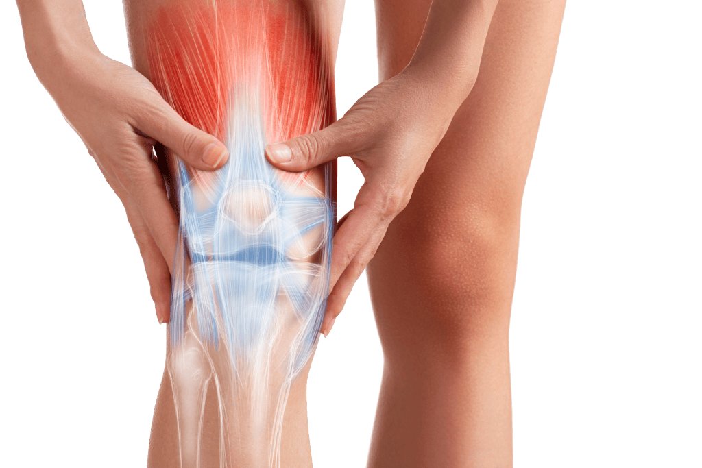 Mensch hält schmerzhaftes Knie, medizinische Illustration der Kniegelenkstruktur.